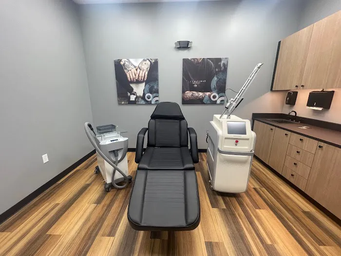 Removery Tattoo Removal & Fading 6