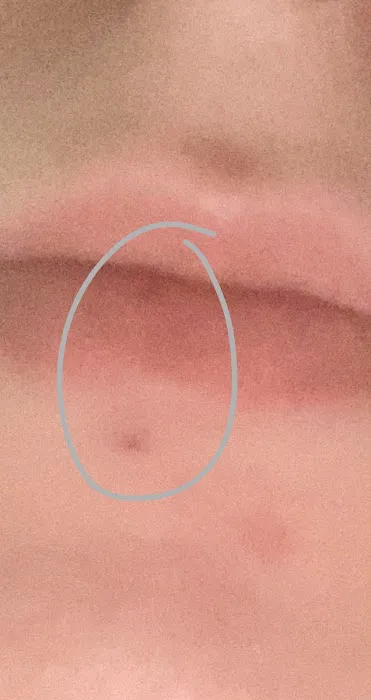 Porcupine Piercing & Body Modification 1