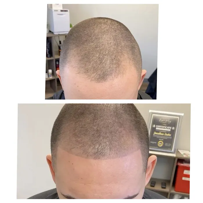Prodigy SMP Scalp Micropigmentation 8