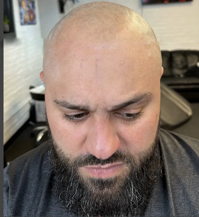 Prodigy SMP Scalp Micropigmentation 6
