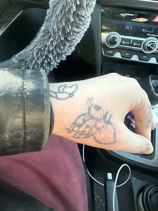 Removery Tattoo Removal & Fading 4