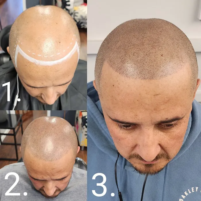 Scalp & Skin Artistry Scalp Micropigmentation 0