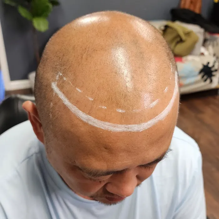 Scalp & Skin Artistry Scalp Micropigmentation 4