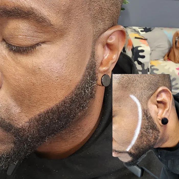 Scalp & Skin Artistry Scalp Micropigmentation 3