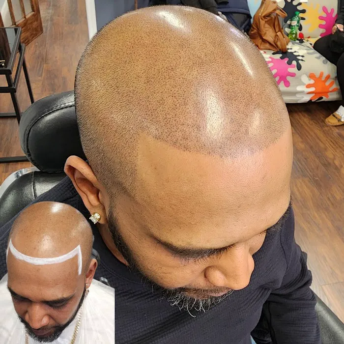 Scalp & Skin Artistry Scalp Micropigmentation 5