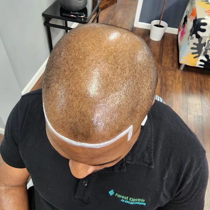 Scalp & Skin Artistry Scalp Micropigmentation 7