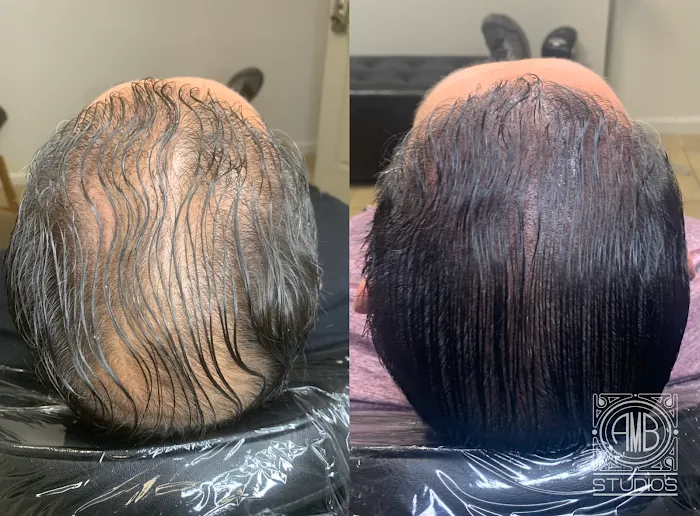 CONFIDENTIAL INK is A 3-D Areola Restoration Studio, Specializing in Paramedical & Cosmetic Tattoos 6