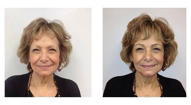 Richard Victor Permanent Cosmetics & Microblading 4