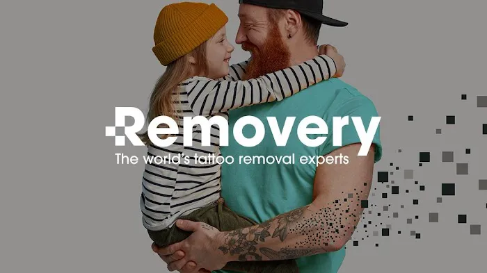 Removery Tattoo Removal & Fading 1