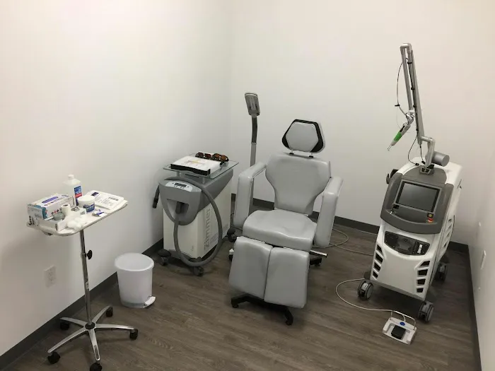 Removery Tattoo Removal & Fading 6
