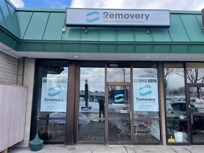 Removery Tattoo Removal & Fading 1