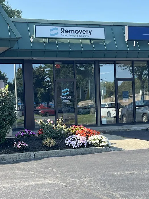 Removery Tattoo Removal & Fading 5