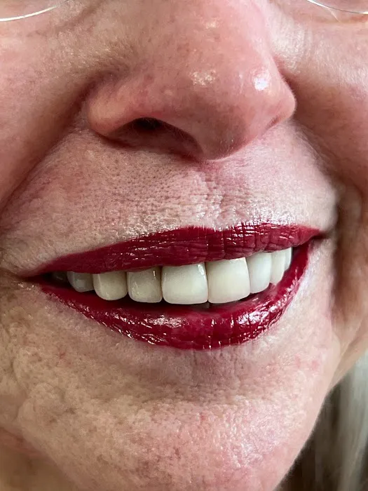 Permanent Cosmetics of NY 6