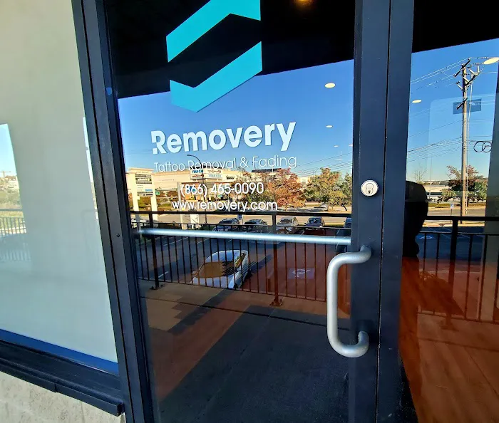 Removery Tattoo Removal & Fading 4