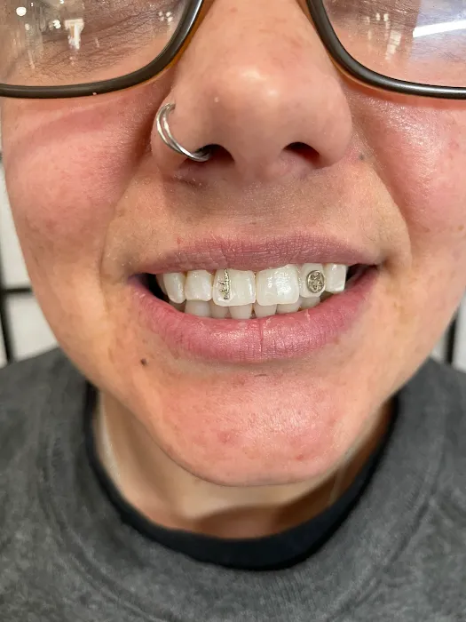 Tooth Gems By Shannon 4