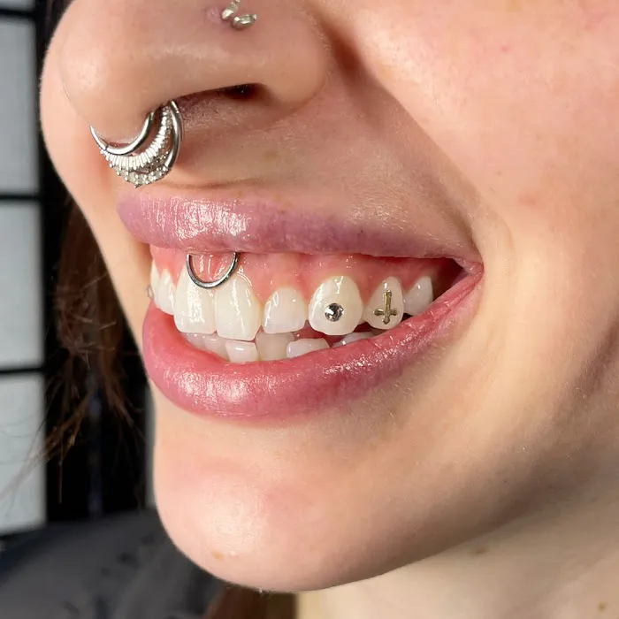 Tooth Gems By Shannon 3
