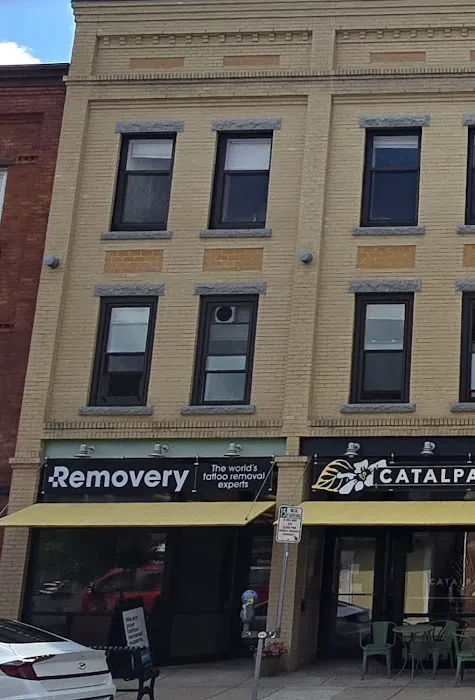 Removery Tattoo Removal & Fading 1