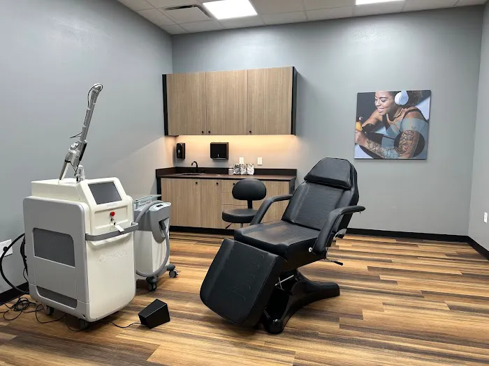 Removery Tattoo Removal & Fading 1