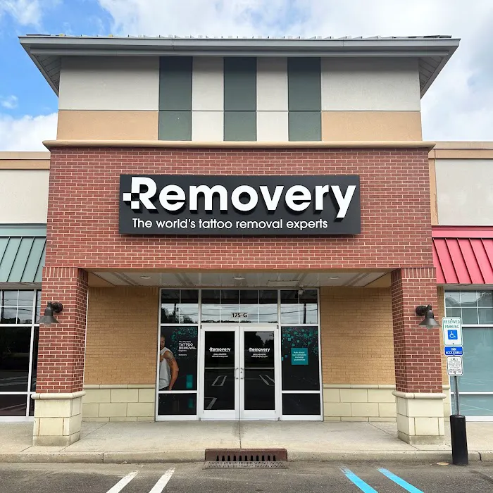 Removery Tattoo Removal & Fading 5