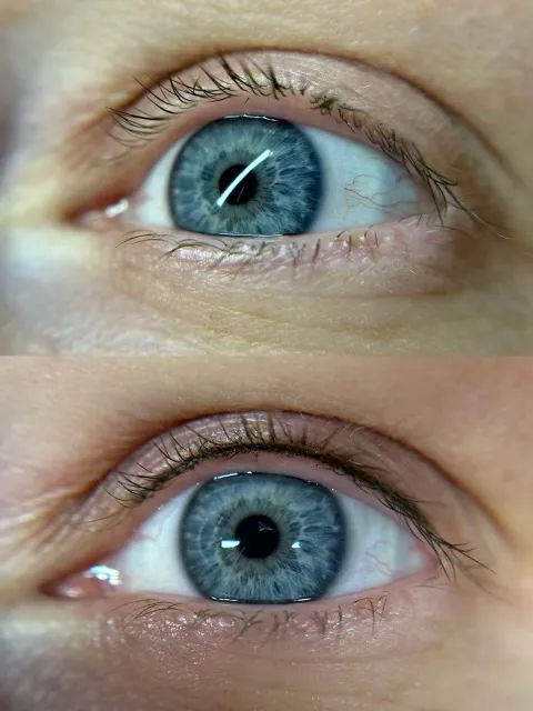 Eclipse Cosmetic Tattoo 1