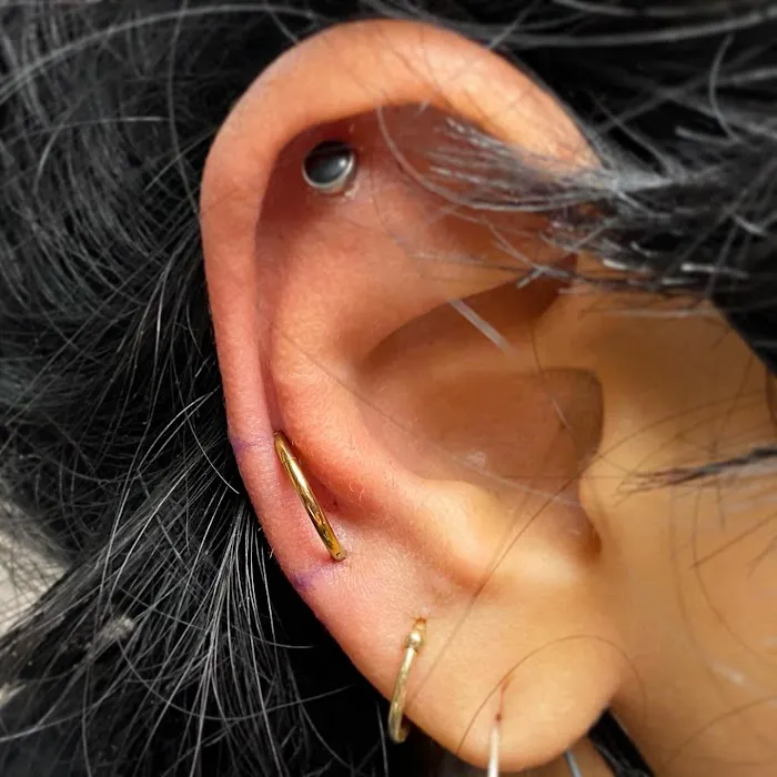 Kissed by a Needle 1