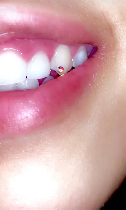 Kissed by a Needle 4