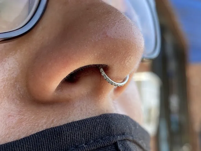 Kissed by a Needle 9