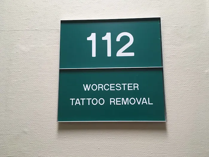 Worcester Tattoo Removal 5