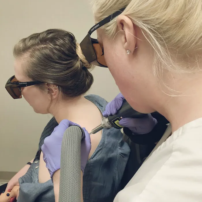 Worcester Tattoo Removal 7