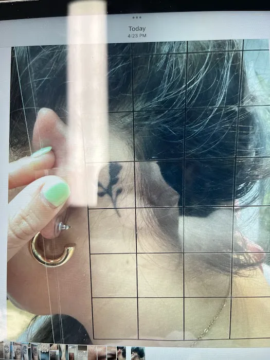 Removery Tattoo Removal & Fading 3