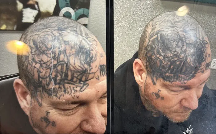 Removery Tattoo Removal & Fading 7