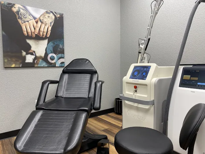 Removery Tattoo Removal & Fading 4