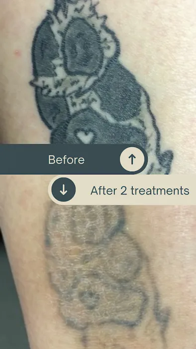 Disappearing Ink/ Jill & Bonnie's Hair Removal and Skin Clinic/ The Finished Line Permanent Cosmetics 3