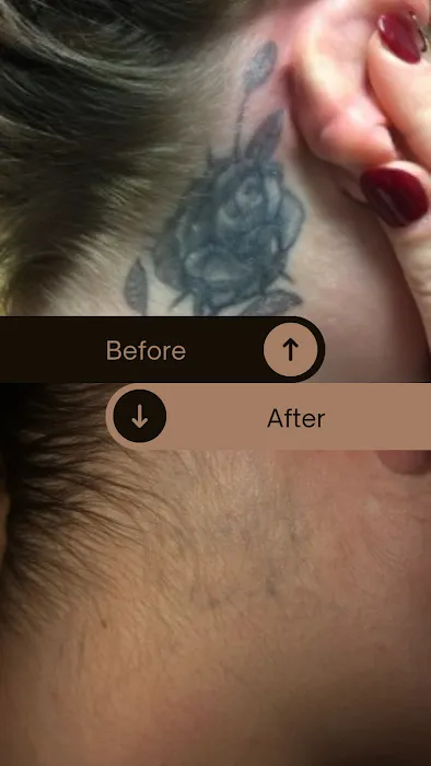 Disappearing Ink/ Jill & Bonnie's Hair Removal and Skin Clinic/ The Finished Line Permanent Cosmetics 4