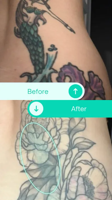 Disappearing Ink/ Jill & Bonnie's Hair Removal and Skin Clinic/ The Finished Line Permanent Cosmetics 5