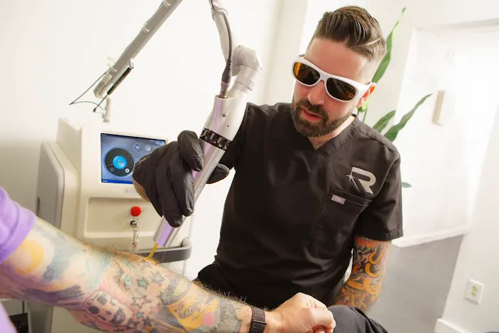 Rethink Laser Tattoo Removal 9