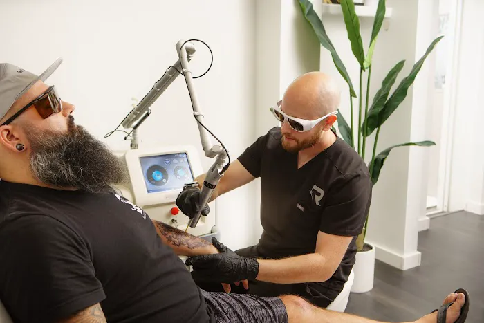 Rethink Laser Tattoo Removal 0