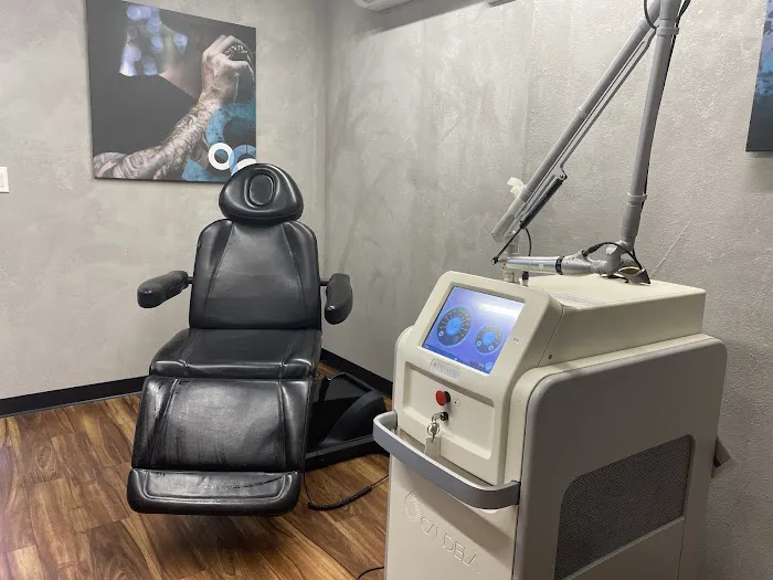 Removery Tattoo Removal & Fading 0