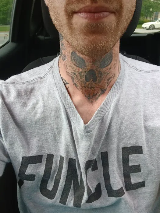Removery Tattoo Removal & Fading 4