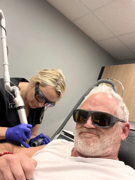 Removery Tattoo Removal & Fading 2