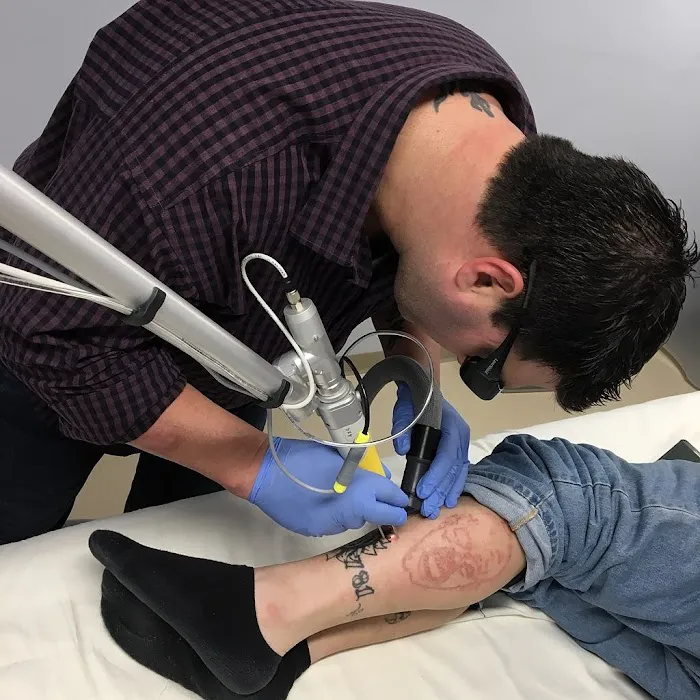 New Beginnings Laser Tattoo Removal 2