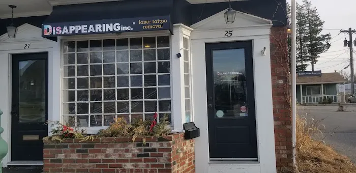 Removery Tattoo Removal & Fading 1
