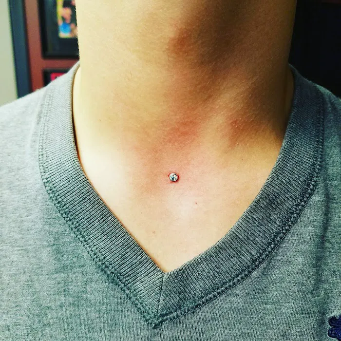 Pins & Needles 7