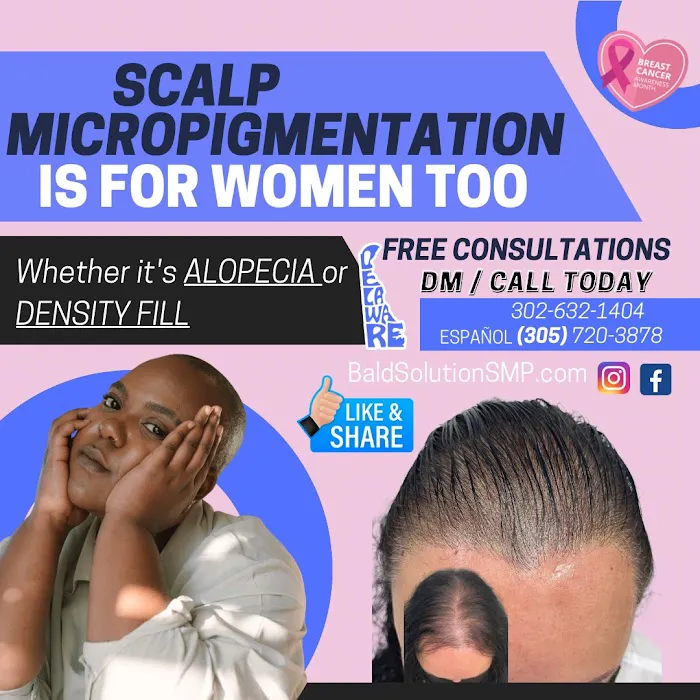 Bald Solution LLc Scalp Micropigmentation 5