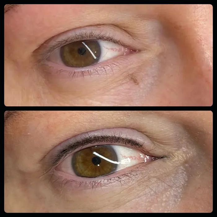Glambar 3