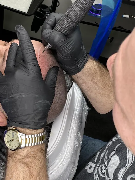 Prestige scalp Micropigmentation 0