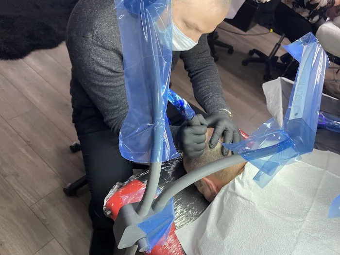 Prestige scalp Micropigmentation 1