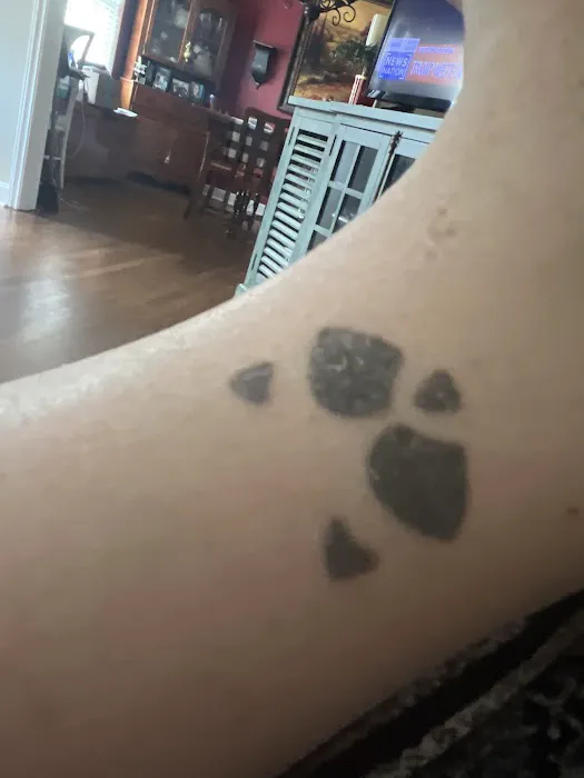 Removery Tattoo Removal & Fading 0