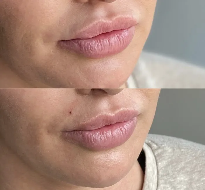 The Blush Artistry 3