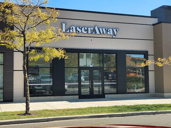 LaserAway Madison 0